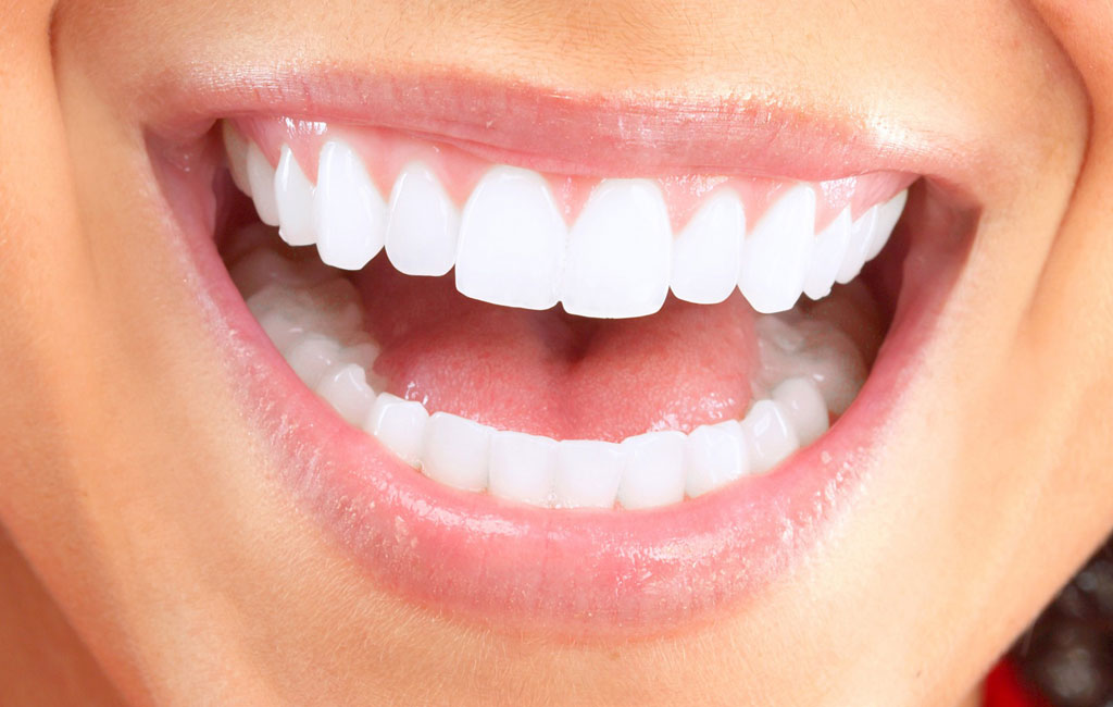 با چه نکات مراقبتی ماندگاری لمینت دندان را افزایش دهیم؟