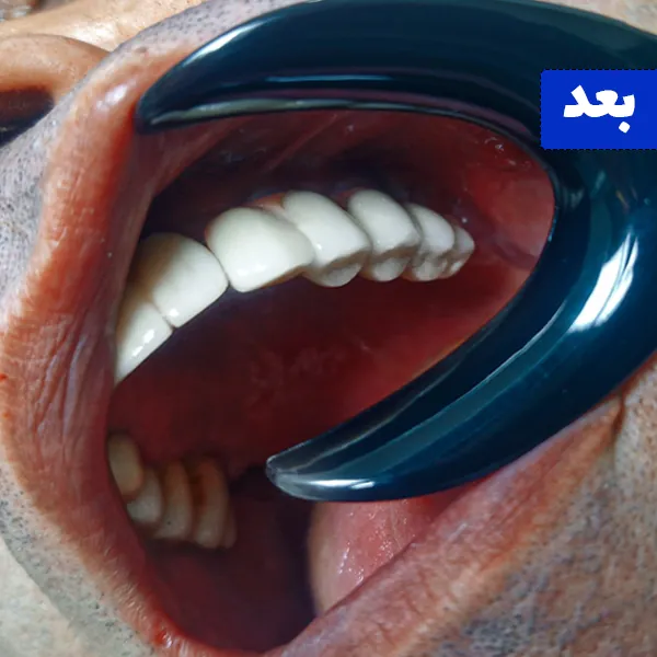 بعد
