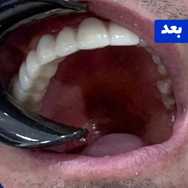بعد
