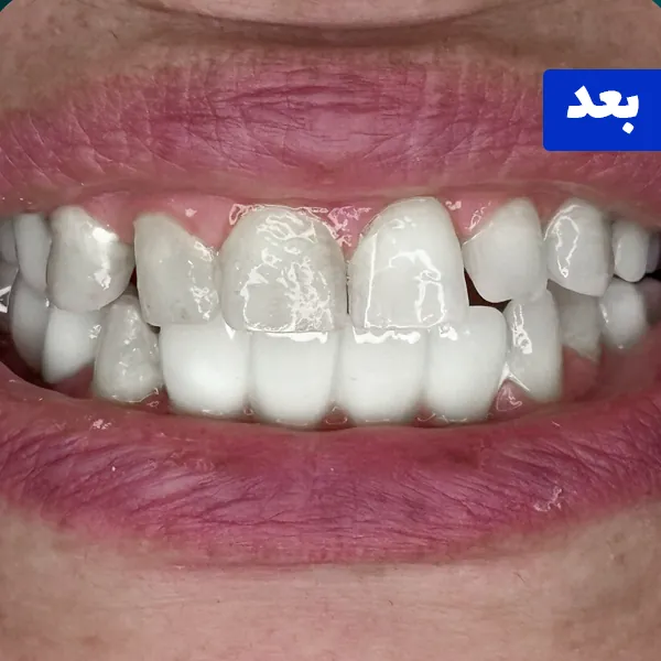 بعد