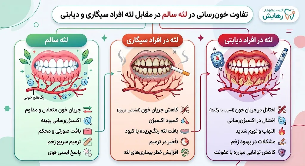 تفاوت خون‌رسانی در لثه سالم و لثه فرد سیگاری یا دیابتی