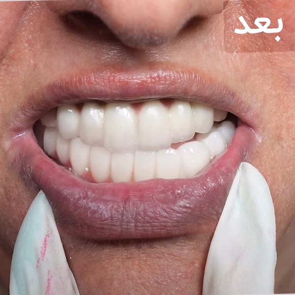 بعد