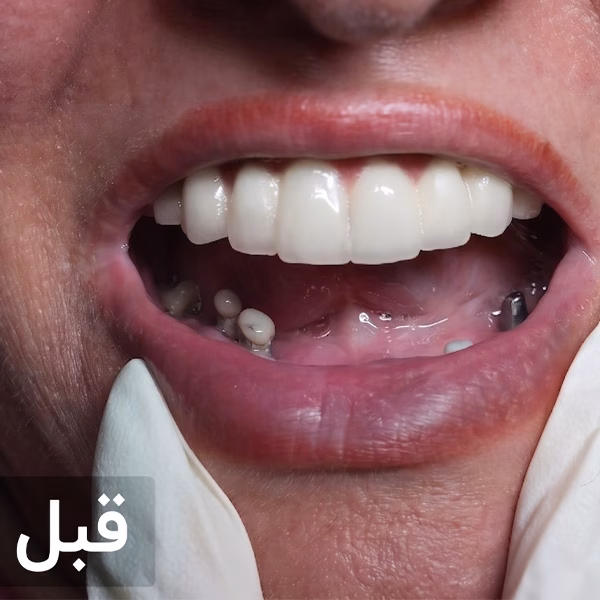 قبل