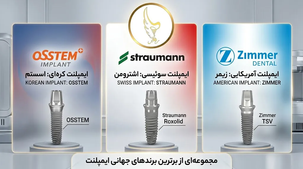 برترین برند های جهانی ایمپلنت